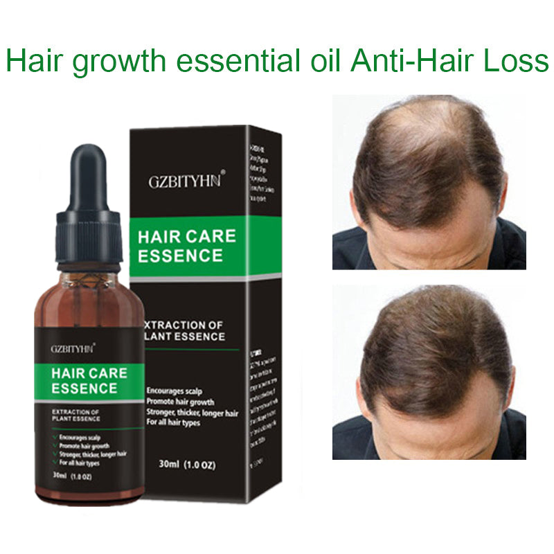 Hair Growth Oil Hair Growth Oil Oem Hair Care Essential Oil Main image