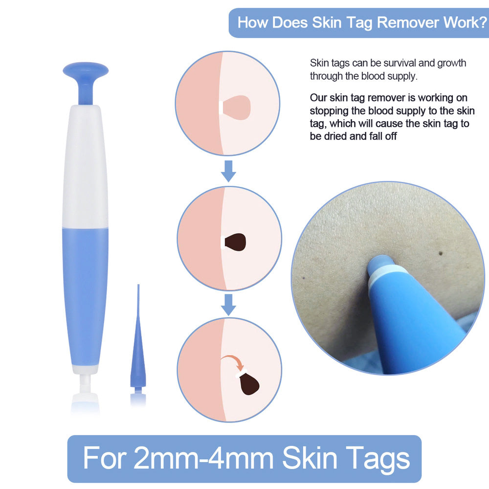 Skin Tag Removal Kit Home Use Mole Wart Remover Micro Band Skin Tag Treatment Tool Easy To Clean Skin Care Tool Secondary image