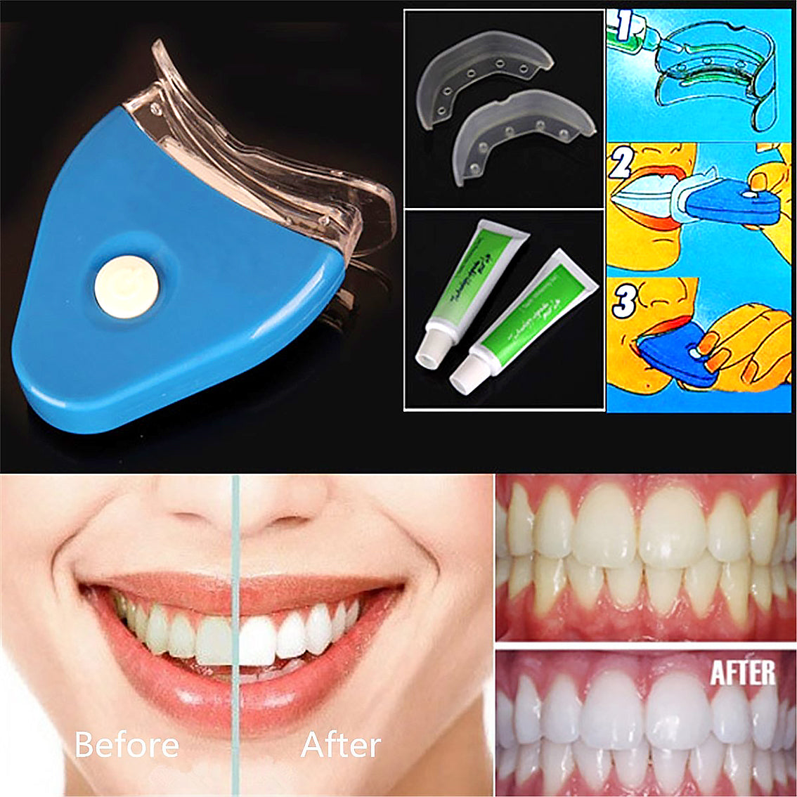 Oral Gel Teeth Tooth Whitening Whitener Dental Bleaching LED Secondary image