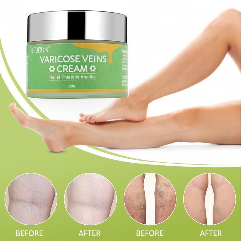 Vein Cream Red Blood Streaks Repair Earthworm Leg Bruises Bulge Relief Pain Safflower Skin care lotion Varicose Cream Main image